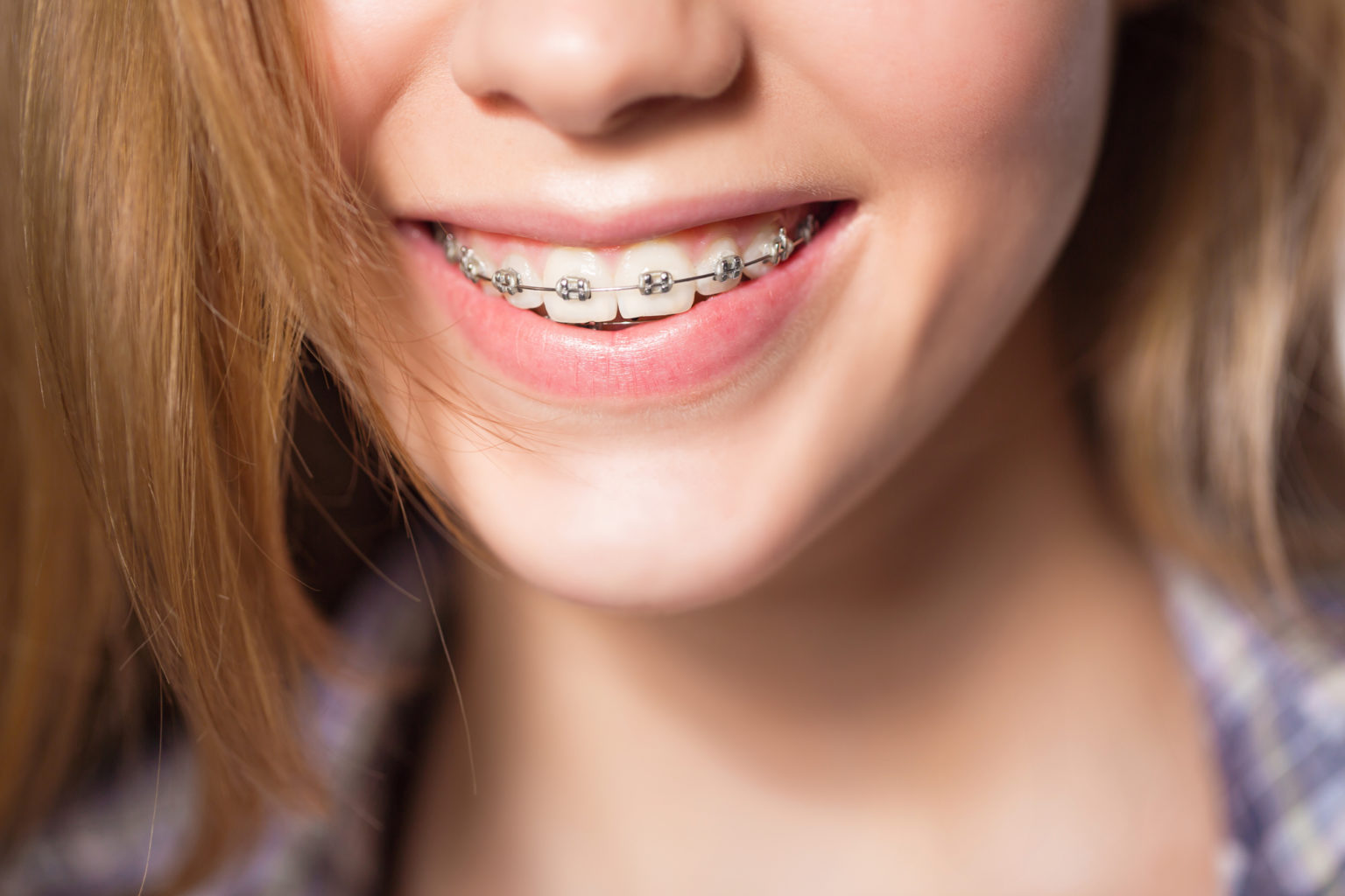 The History of Orthodontics Setting the Record Straight